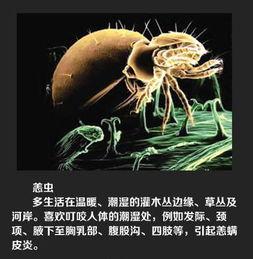 绍兴新闻爆料平台蜱虫,惊现蜱虫隐患，专家提醒防范措施！